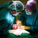 cesarean section surgery: c-section