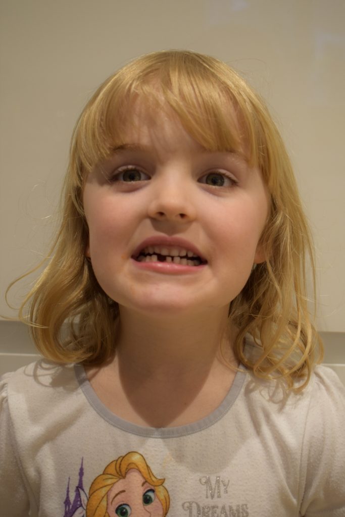 The one with the tooth fairy